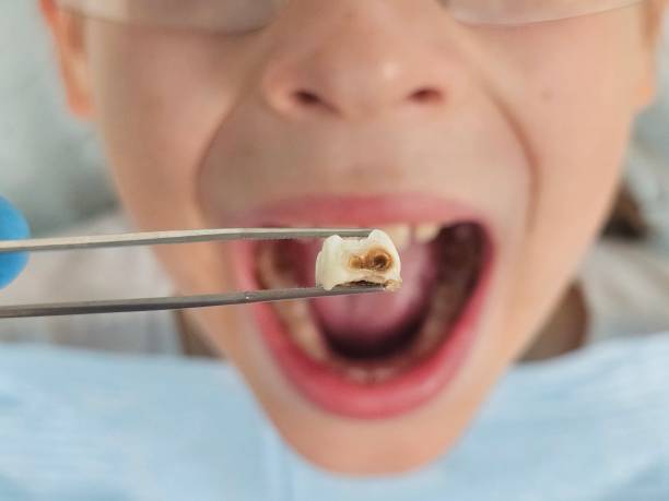 Best Weekend Emergency Dentist in Courtland, VA
