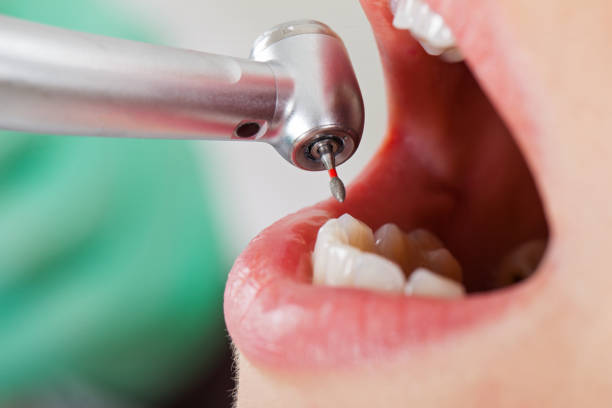 Best Emergency Treatment for Toothache in Courtland, VA